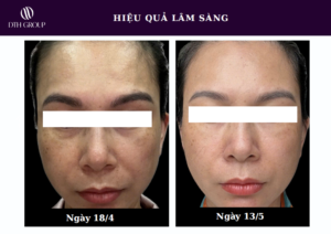 Khách hàng sử dụng Save B32