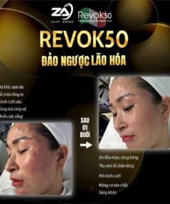 Trước và sau khi sử dụng Revok 50